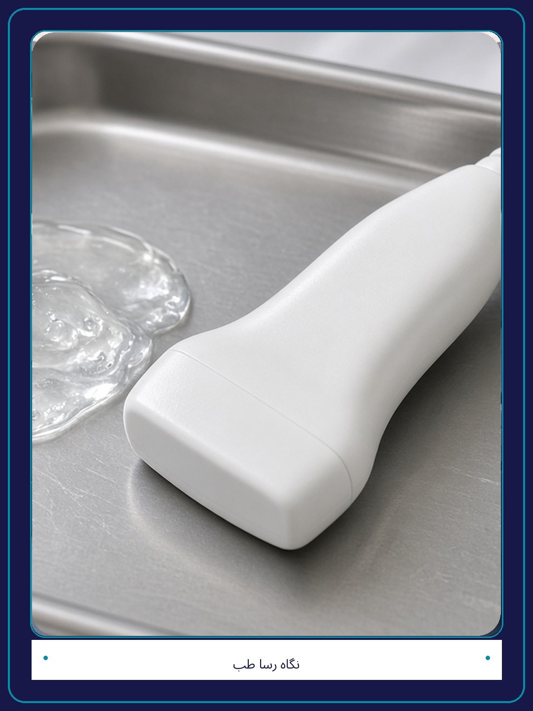 سونوگرافی واریس چیست و چه کاربردی دارد؟